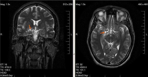 Diagnostyka molekularna kluczem innowacyjnego postępowania onkologicznego