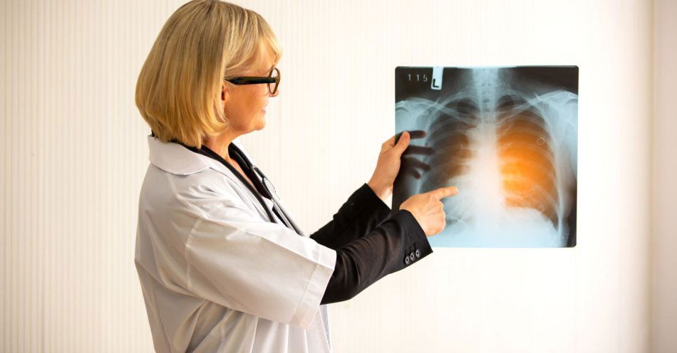 zdjęcie: 200 przeszczepień płuc w siedem lat w Uniwersyteckim Centrum Klinicznym / v7112575