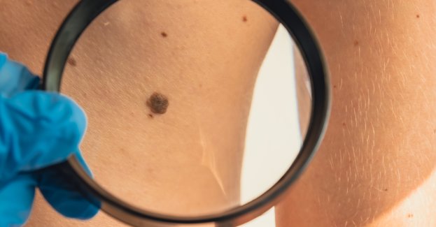 Dni Świadomości Czerniaka w Tomaszowie Mazowieckim