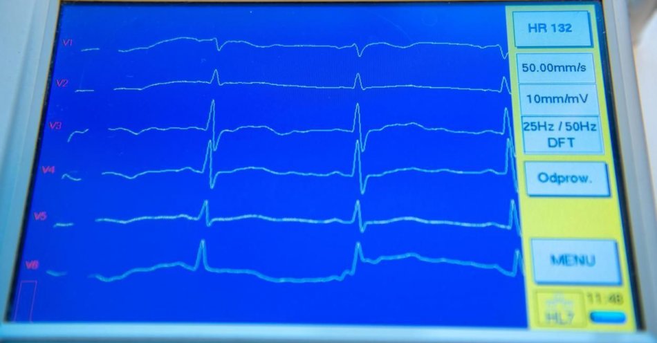 zdjęcie: Naukowcy z PW nakarmili sztuczną inteligencję danymi z badań EKG / fot. PAP