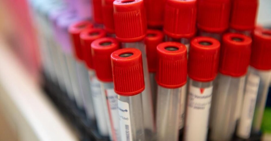 zdjęcie: Obniżenie cholesterolu to tysiące mniej zawałów i udarów / fot. PAP