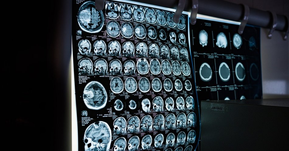 zdjęcie: Oddział neurologiczny Szpitala Megrez wznawia działalność / pixabay/6841384